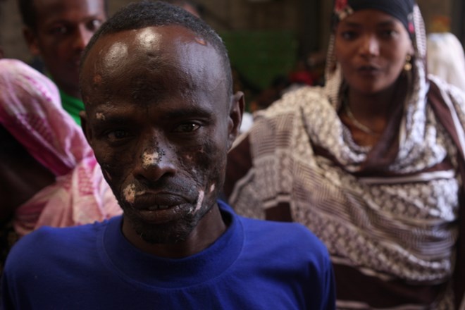 2017118636457217452449210ethiopia_man