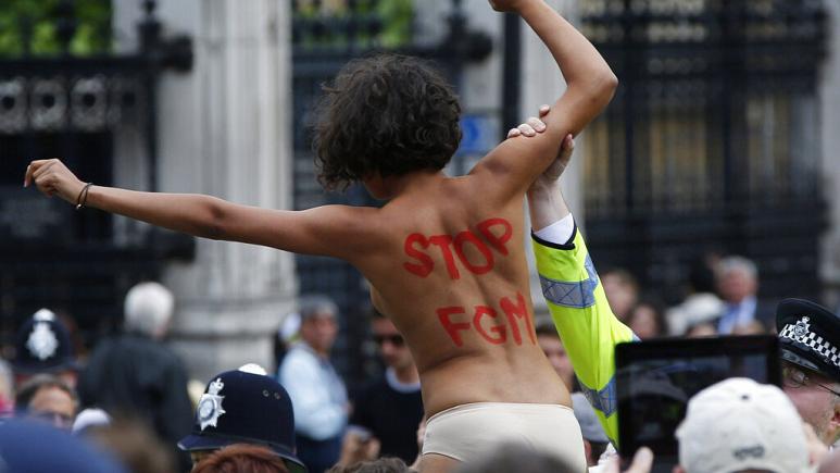 FGM